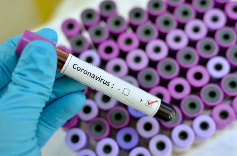 <span style='color:#780948'>ARCHIVED</span> - Spanish antiviral medication reported to have 100 per cent success in treating Covid