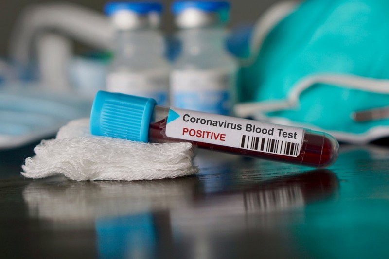 <span style='color:#780948'>ARCHIVED</span> - Sharp spike in coronavirus data expected as Spain introduces rapid testing techniques